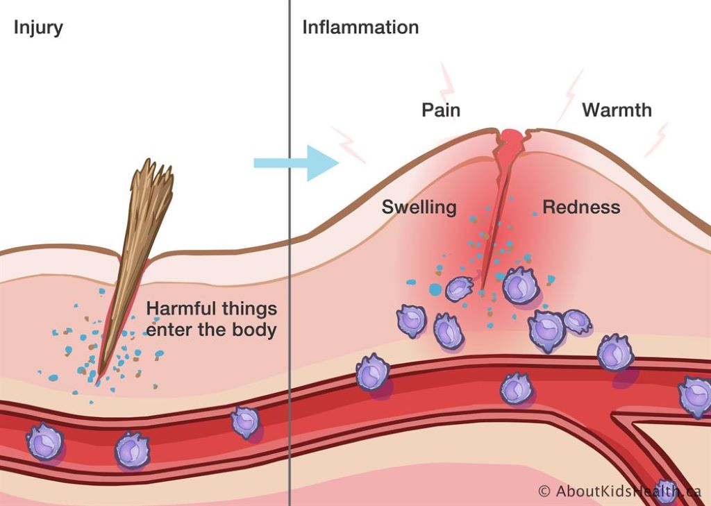 What is an auto inflammatory skin condition?